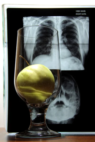 Medical metaphor. Apple in glass over x-ray film of human skull