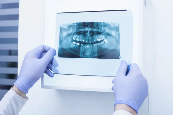 Male doctor looking at dental x-ray