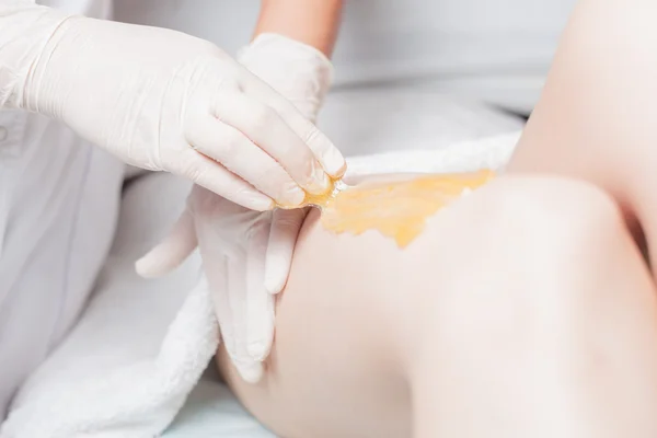 Sugaring epilation skin care with liquid sugar at legs