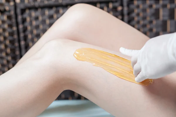 Sugaring epilation skin care with liquid sugar at legs