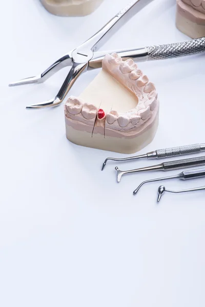 Teeth mold and basic dental tools on white table