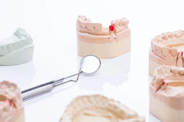 Teeth molds with basic dental tools on a bright white table