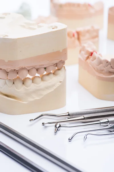 Teeth molds with basic dental tools on a bright white table