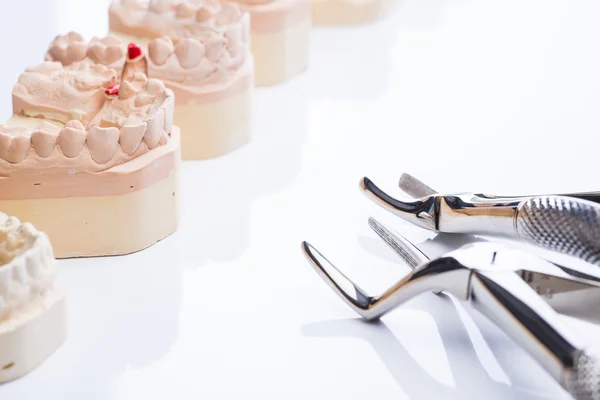 Teeth molds with basic dental tools on a bright white table