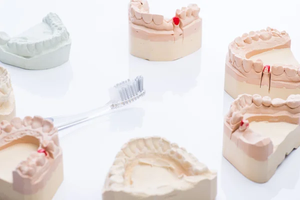 Teeth molds with toothbrush on a bright white table