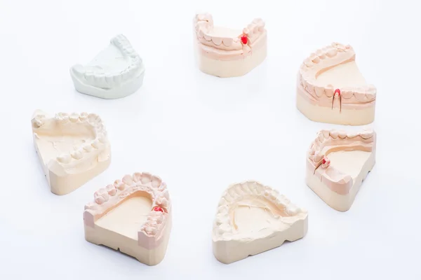 Teeth molds on a bright white table