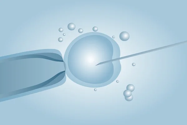 Microscopic artificial insemination, In vitro fertilisation IVF