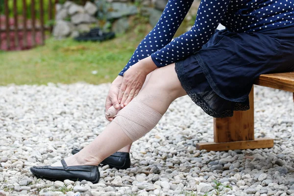 Woman with varicose veins applying compression bandage