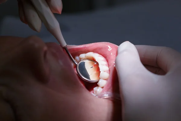 Patient getting her interdental spaces examined