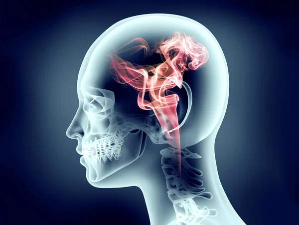 Xray image of human head with flames