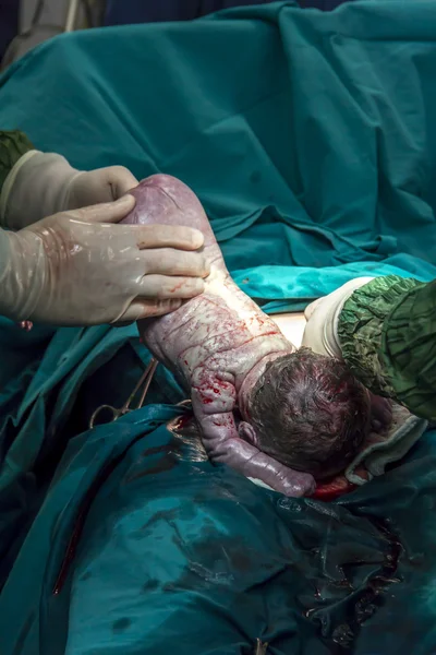 Childbirth in operation room c-section surgery