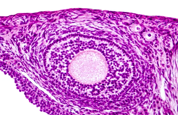 Light micrograph of ovary