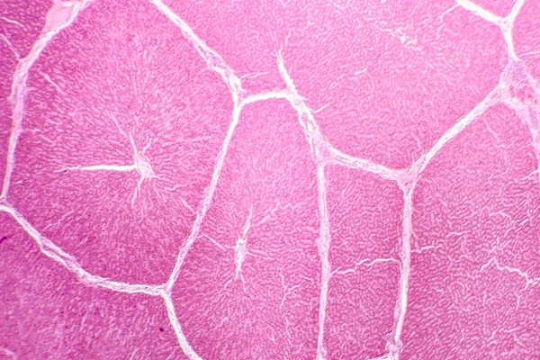 Light micrograph of a liver
