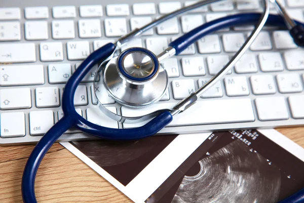 A medical stethoscope near a laptop on a wooden table