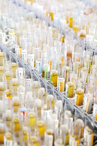 Test Tubes for Urine Analysis in Laboratory