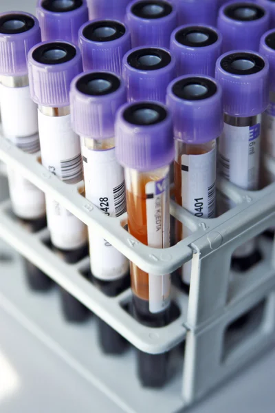 Rack with test tubes of blood