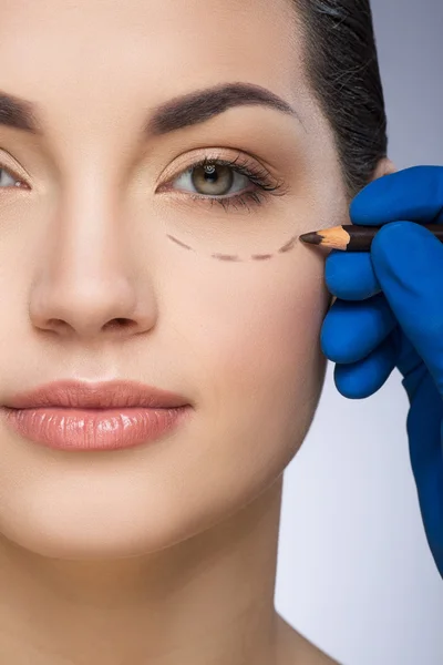 Plastic surgeon drawing dashed line under eye