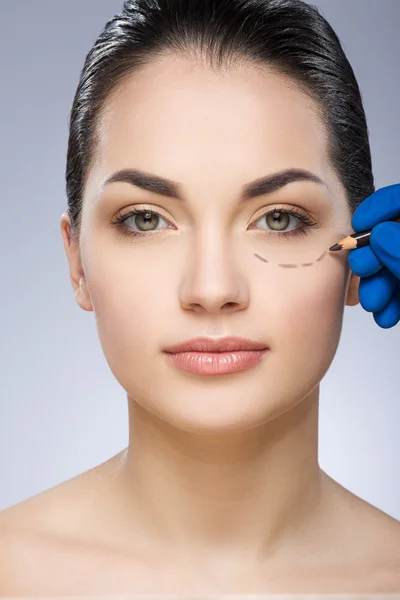 Plastic surgeon drawing line under eye