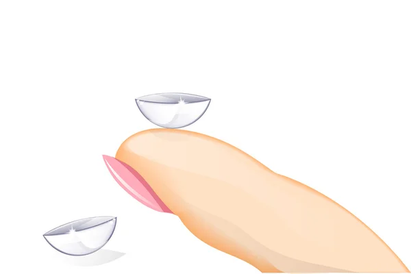 Contact lenses, ophthalmology