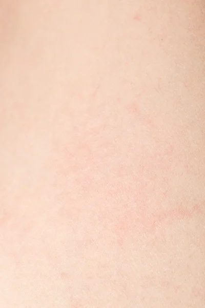 Human skin texture with black hairs on the skin for healthy back