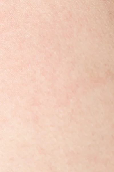 Human skin texture with black hairs on the skin for healthy back