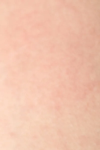 Human skin texture with black hairs on the skin for healthy back