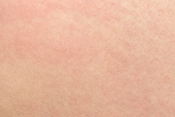 Human skin texture with black hairs on the skin for healthy back