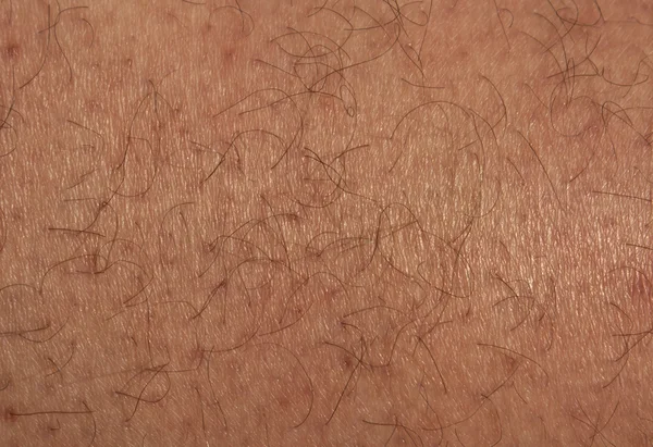 Male leg skin with hair.