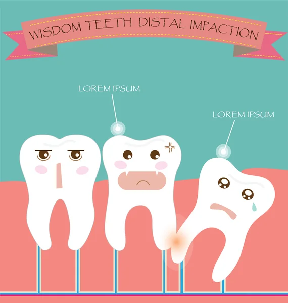 Wisdom Teeth Distal Impaction