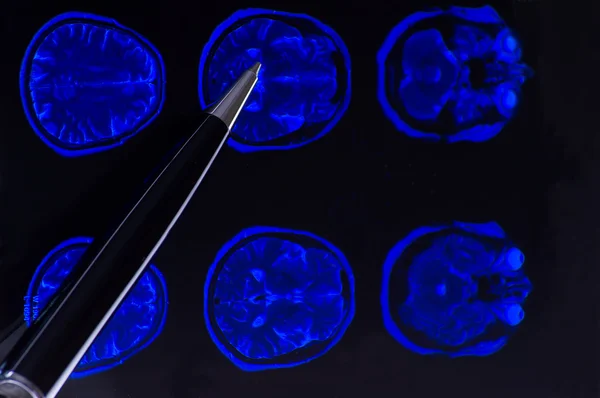 X-ray image of the brain computed tomography