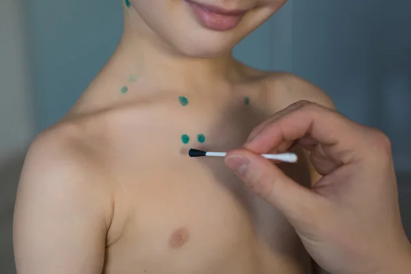 Mother draws a green points on his child skin