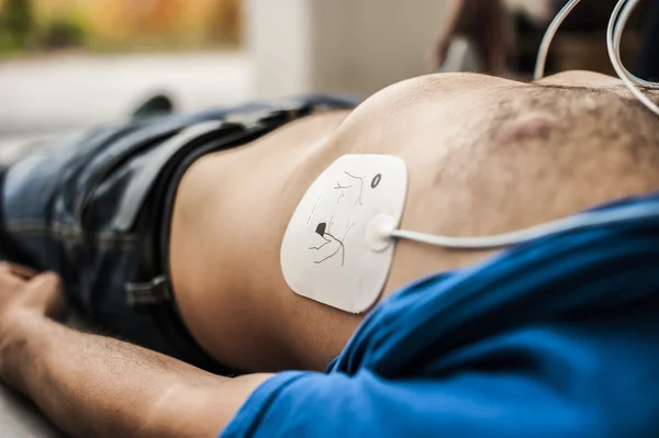 Defibrillator electrodes being applied to unconscious man