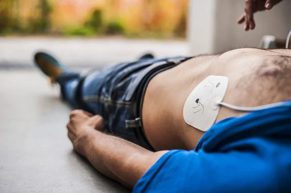 Unconscious man being assisted with defibrillator electrodes