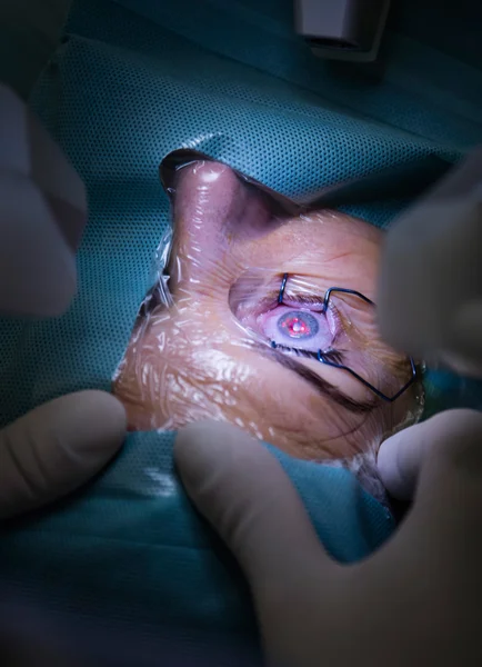 Eye surgery in hospital