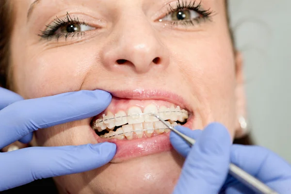 Orthodontist tightening braces to female patient