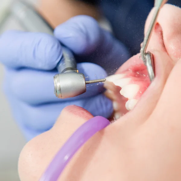 Female patient during Dental drill