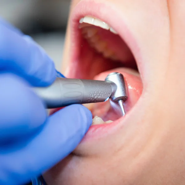 Dental drill close-up