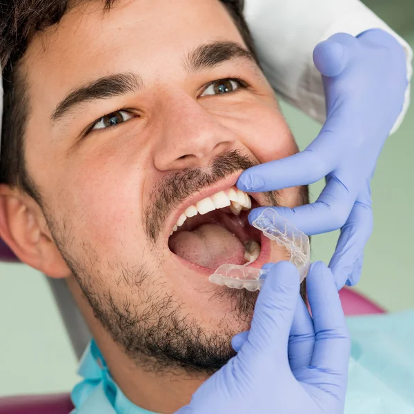 Placing invisible braces to patient
