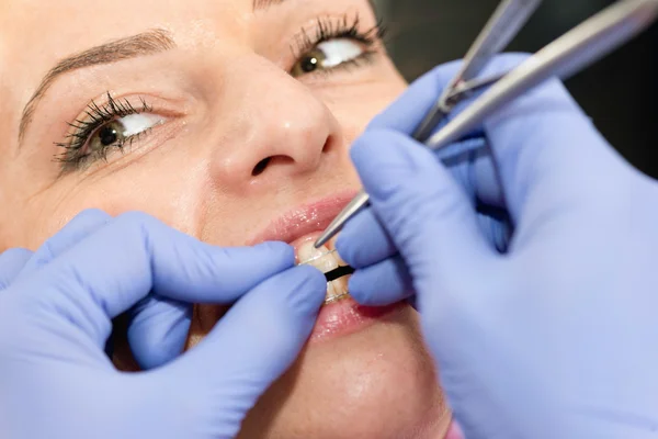 Dentist tightening braces  on female patient