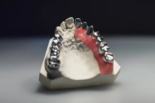 Denture anatomical model