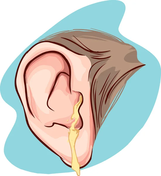 Vector illustration of a ear infection