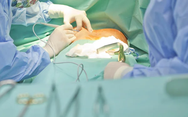 Breast augmentation surgery in the operating room surgeon tools implant