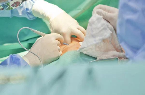 Breast augmentation surgery in the operating room surgeon tools implant