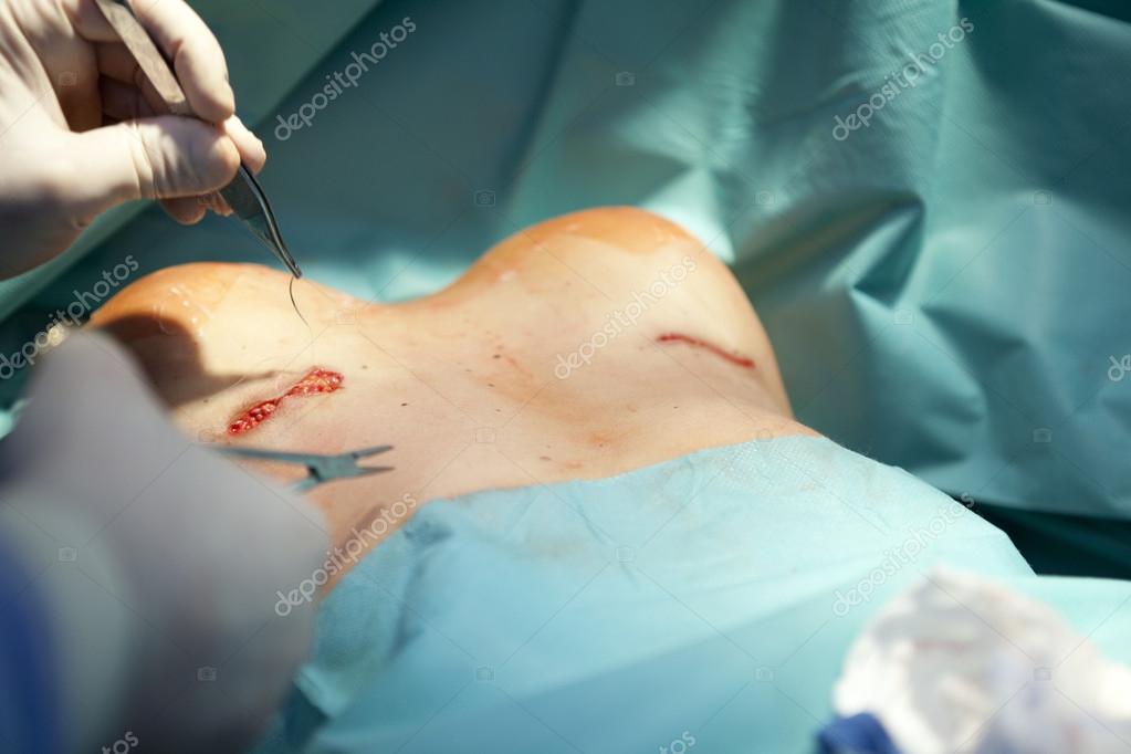 With you Vinings breast augmentation surgeon Vinings breast augmentation surgeon regret