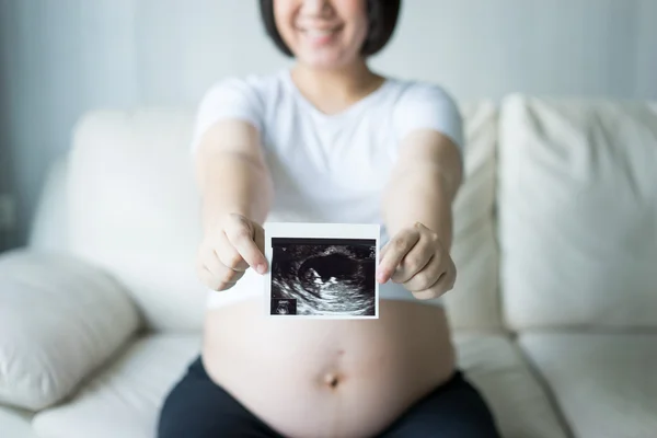 Pregnant woman with ultrasound scan picture