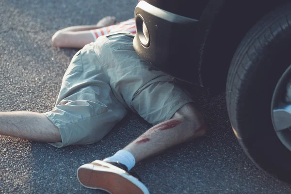 Child with bloody leg in front of stopped car