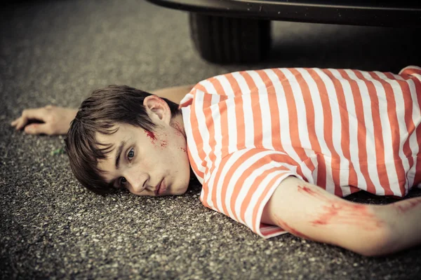 Unconscious boy with eyes open and scratched arm