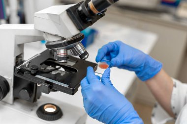 Mikroskop içinde laboratuvar teknisyeninin kan örneği..