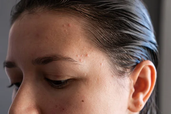 Retrato Cerca Una Chica Aprieta Grano Frente Momento Incómodo Antes —  Fotos de Stock