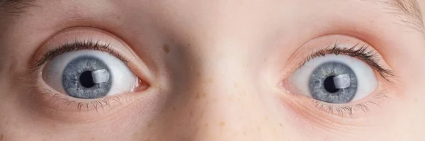 Barevné Oči Šestiletý Chlapec — Stock fotografie